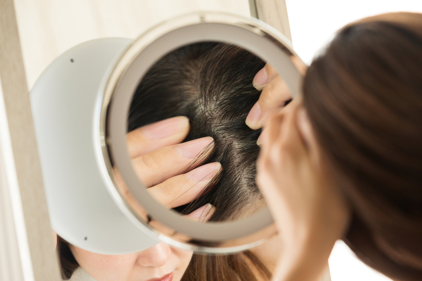 頭皮を鏡で見る女性の画像